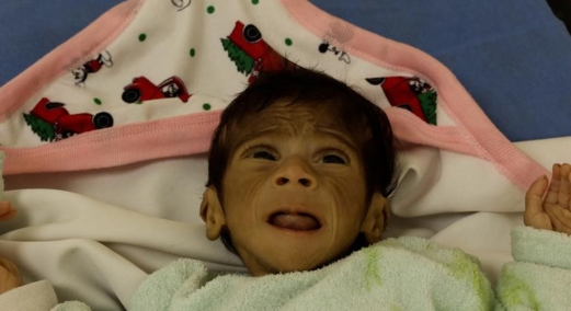 "يونيسف" تحذر من تفشي الأمراض بين أطفال غزة وتدعو لتكثيف المساعدات الإنسانية