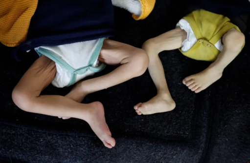 صحة غزة تحذر من تسجيل حالات الشلل الرخو الحاد بأعداد غير مسبوقة صحة غزة تحذر من تسجيل حالات الشلل الرخو الحاد بأعداد غير مسبوقة