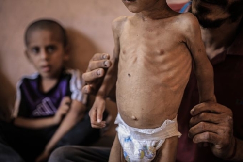 هآرتس: جدعون ساعر "وزير التجويع" خانق غزة
