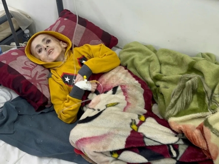 "CSIS": آثار المجاعة في غزّة ستستمر لأجيال عديدة "CSIS": آثار المجاعة في غزّة ستستمر لأجيال عديدة