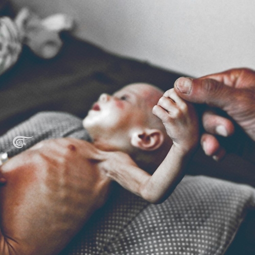 “اليوم العالمي من أجل اليمن”.. حدث دولي لوقف الحرب “اليوم العالمي من أجل اليمن”.. حدث دولي لوقف الحرب