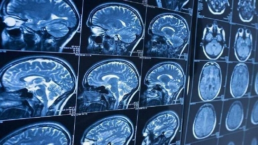 اكتشاف مادة في كبد الحبار لعلاج التهاب الدماغ اكتشاف مادة في كبد الحبار لعلاج التهاب الدماغ