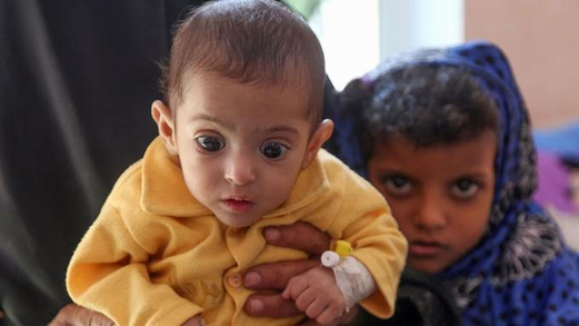 الحرب في اليمن قتلت 85 ألف طفل الحرب في اليمن قتلت 85 ألف طفل