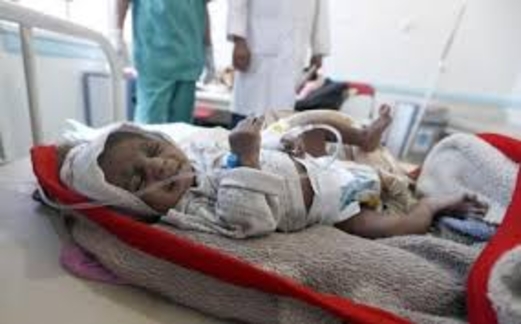 الجوع والأيديولوجية والكوليرا: اليمن بحاجة إلى معونة بالمليارات الجوع والأيديولوجية والكوليرا: اليمن بحاجة إلى معونة بالمليارات