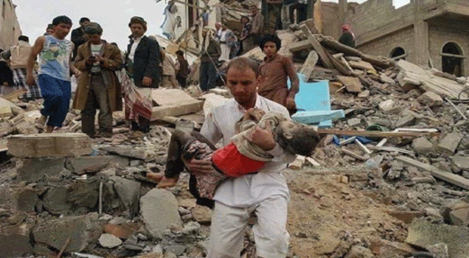 اليمن… ثلاثة مليار دولار للمشاركة في ارتكاب جرائم حرب! اليمن… ثلاثة مليار دولار للمشاركة في ارتكاب جرائم حرب!