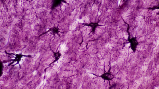 اكتشاف خلايا دماغية “هجينة” غريبة! اكتشاف خلايا دماغية “هجينة” غريبة!