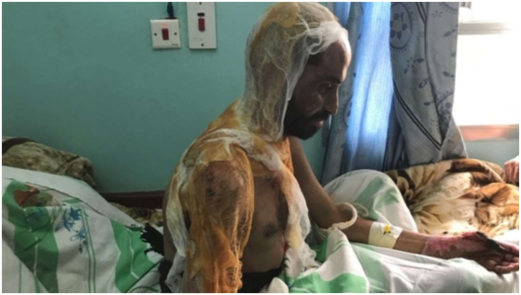 مائة ألف شخص لقوا مصرعهم في الحرب الدائرة في اليمن مائة ألف شخص لقوا مصرعهم في الحرب الدائرة في اليمن