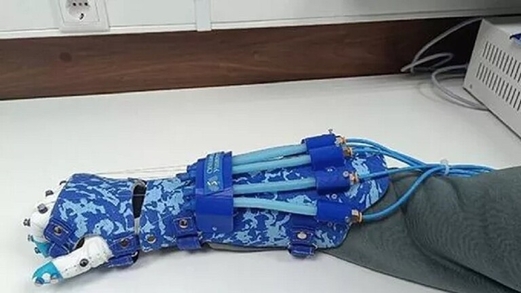 خبراء روس يطورون قفاز يساعد على استعادة المهارات الحركية بعد السكتة الدماغية خبراء روس يطورون قفاز يساعد على استعادة المهارات الحركية بعد السكتة الدماغية