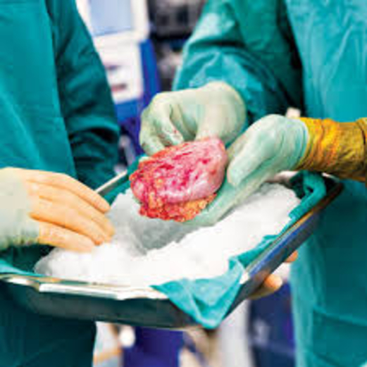 ماذا يحدث لجسم المتبرع بالأعضاء؟ ماذا يحدث لجسم المتبرع بالأعضاء؟