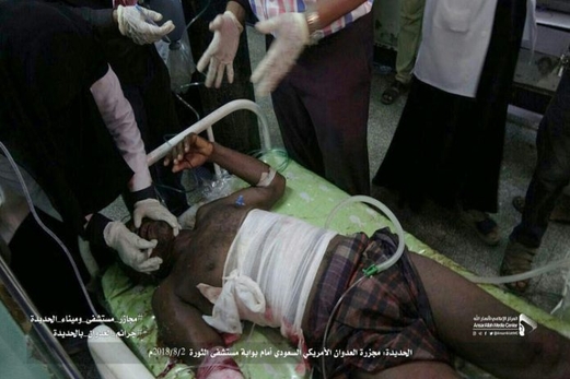 عشرات القتلى في اليمن ، ويلقى اللوم على كلا الطرفين عشرات القتلى في اليمن ، ويلقى اللوم على كلا الطرفين