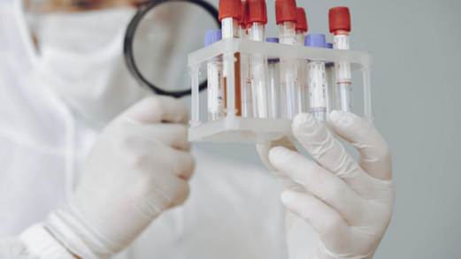 العلماء ينبهون لعلامة تحذير رئيسية رابعة لـ”كوفيد-19″ العلماء ينبهون لعلامة تحذير رئيسية رابعة لـ”كوفيد-19″