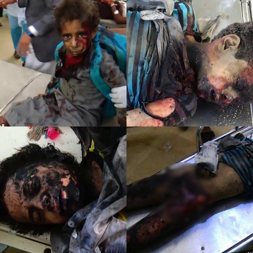 حرب اليمن: قصف حافلة مليئة بالأطفال يثير تساؤلات حول دور الولايات المتحدة حرب اليمن: قصف حافلة مليئة بالأطفال يثير تساؤلات حول دور الولايات المتحدة