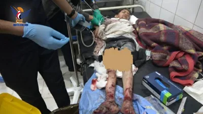 شهداء وجرحى بقصف جوي وصاروخي للعدو السعودي لمناطق بصعدة