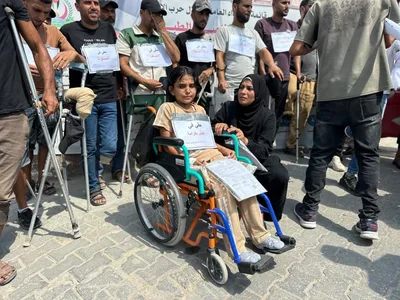 "الصحة بغزة": 5 آلاف حالة بتر و10 آلاف مصاب بحاجة لتأهيل مكثف